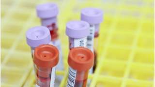 Próbki krwi z laboratorium