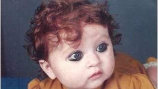 Dziecko z niespotykanym wyglądem zaakceptowało siebie