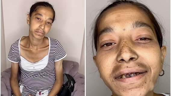 Metamorfoza zaniedbanej kobiety, makijażystka Ayan Shafag totalnie zmieniła jej wygląd