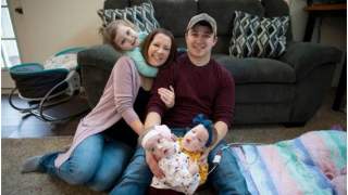 Operacja była konieczna