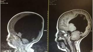 Aborcja miała być jedynym rozwiązaniem dla tej pary. Mimo to rodzice postanowili zawalczyć o życie dziecka