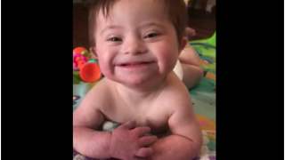 Dziewczynka z zespołem Downa śmieje się w uroczy sposób